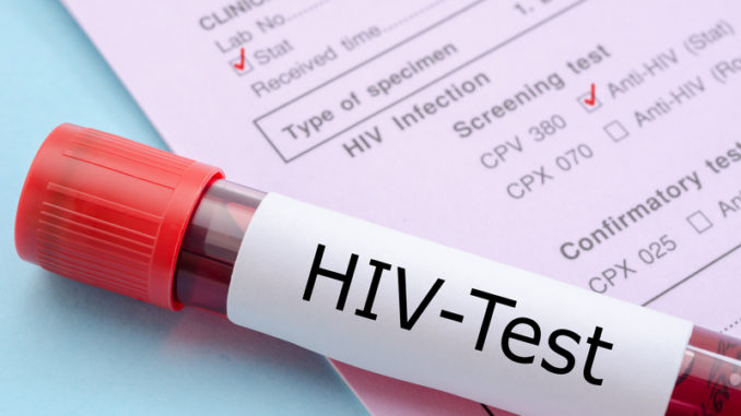 HIV Test AIDS