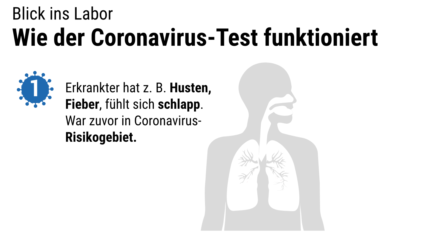 Wie wird eigentlich getestet, ob ich das Coronavirus habe?